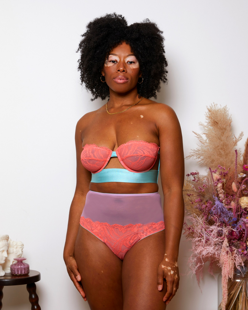 Model with vitiligo wearing a pastel lacy lingerie set